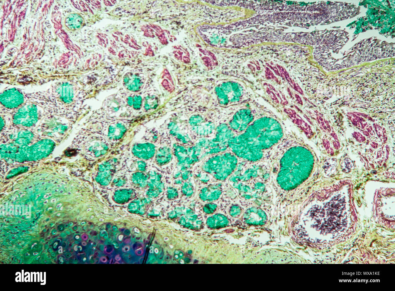 Le tissu pulmonaire Asthme sous le microscope 100x Banque D'Images