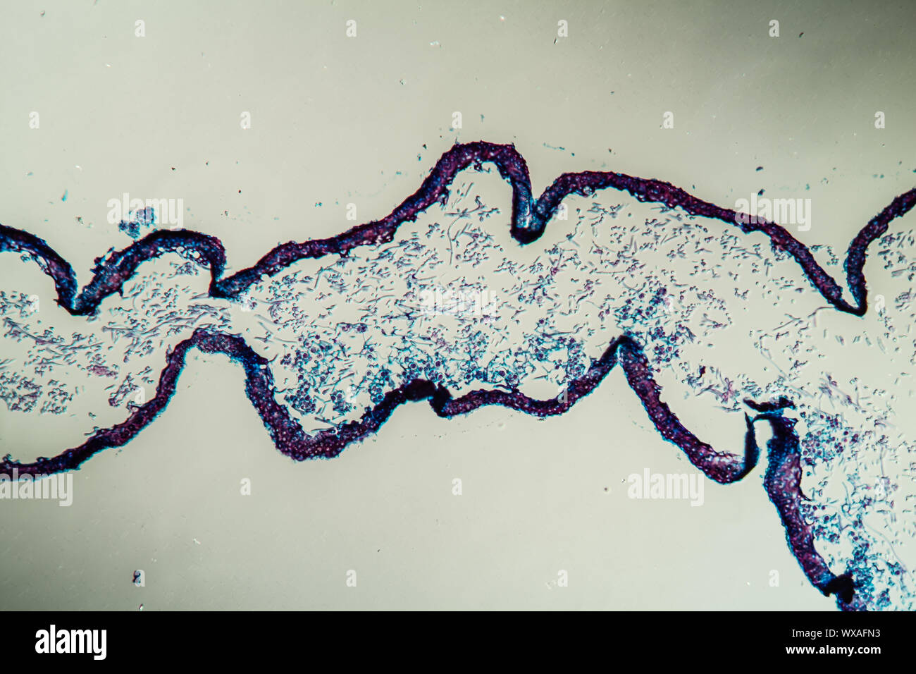 Le lichen coupe transversale de la corps de symbiontes 200x Banque D'Images