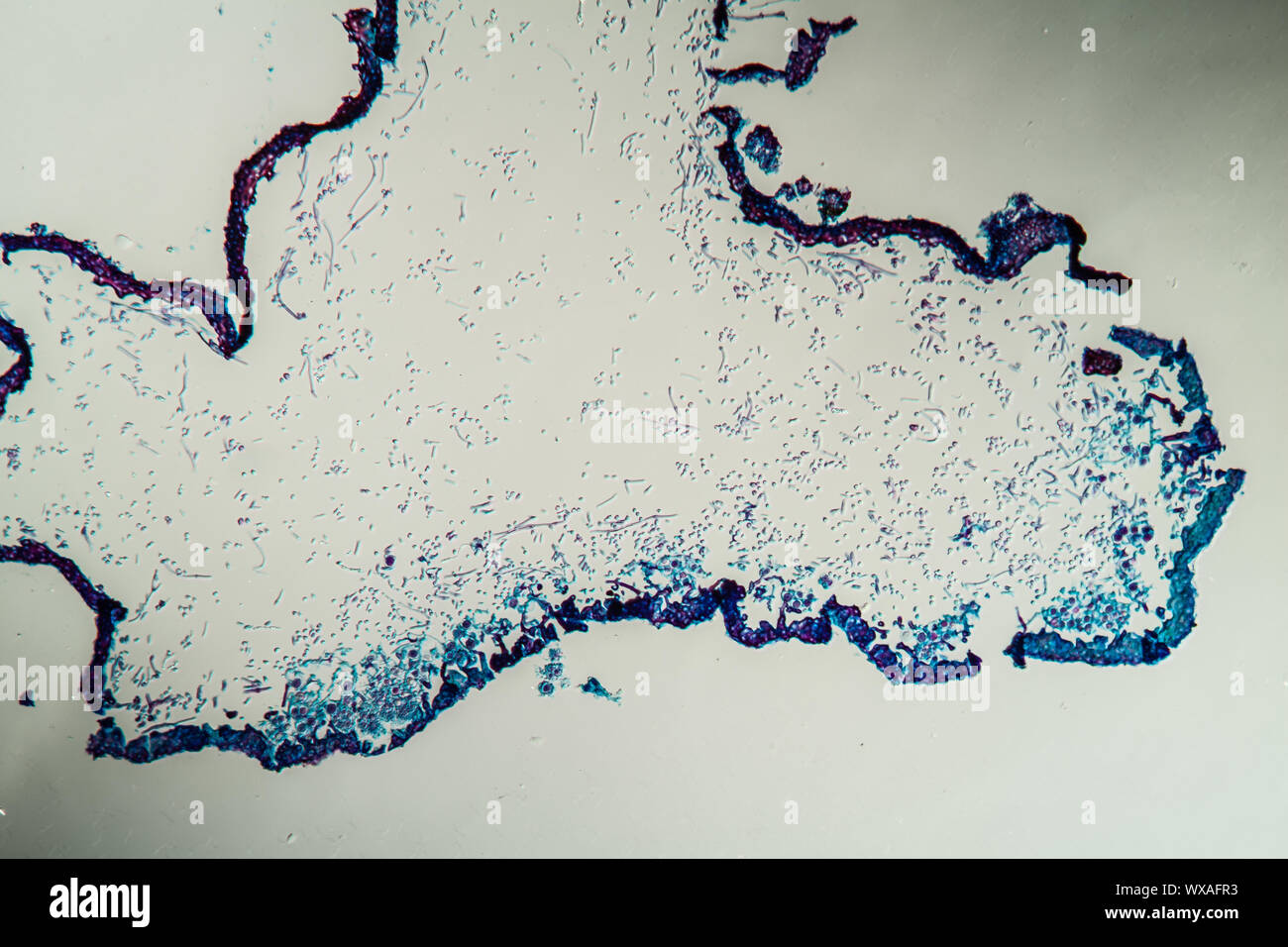 Le lichen coupe transversale de la corps de symbiontes 100x Banque D'Images