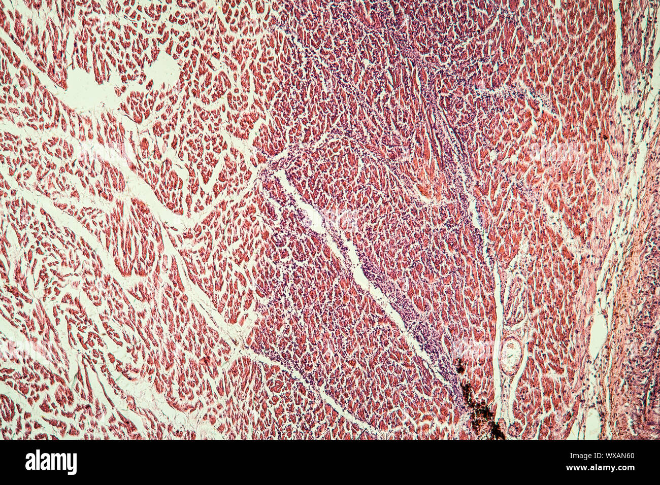 Section de tissu cardiaque sous le microscope 100x Banque D'Images