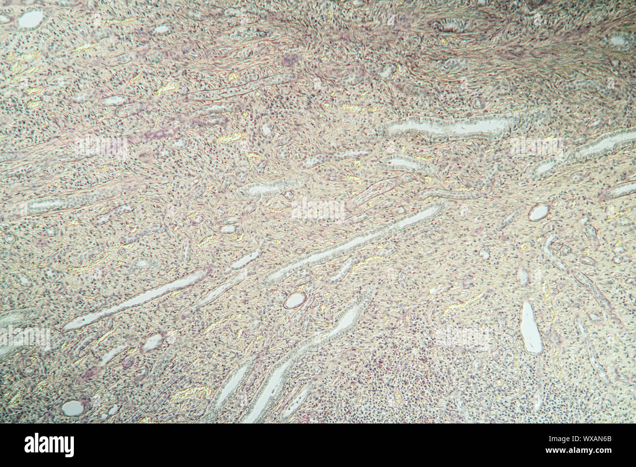 L'hydronéphrose section de tissu sous le microscope 100x Banque D'Images
