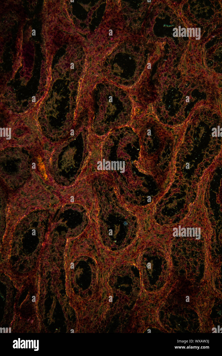 Testicule inguinal section fine sous le microscope 100x Banque D'Images