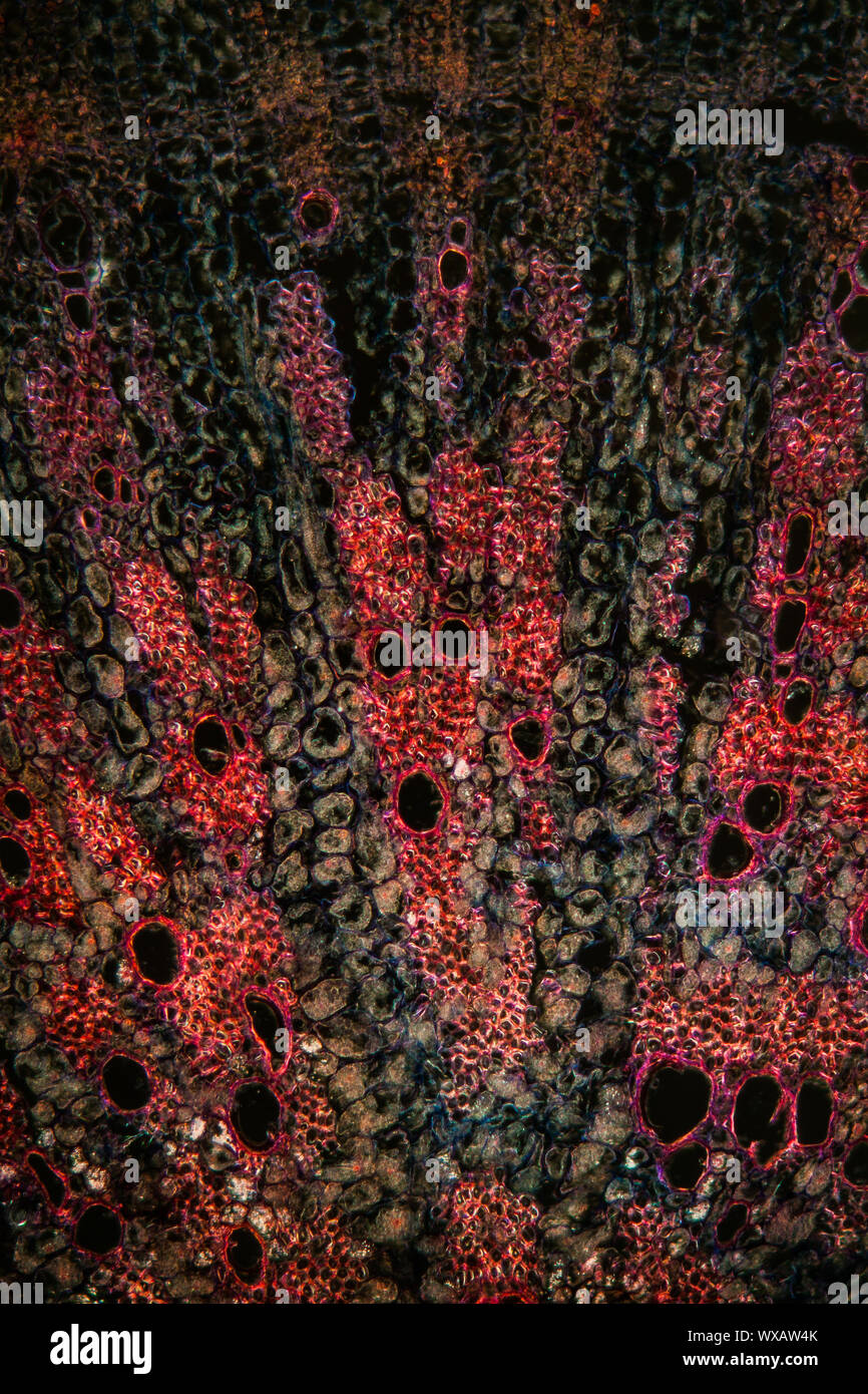 Lupinia section de racine sous le microscope 100x Banque D'Images