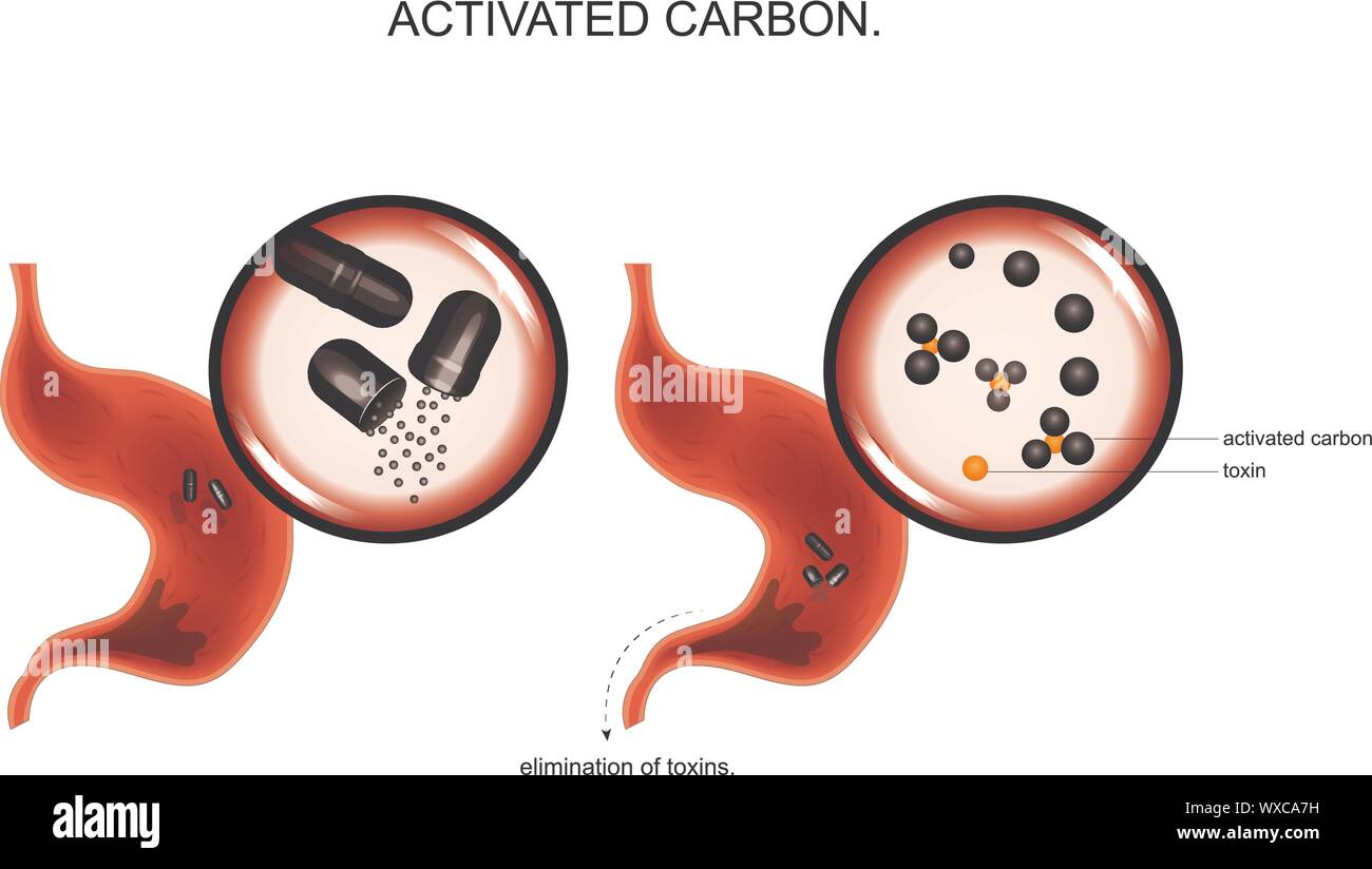 Vector illustration de l'action du charbon actif sur les toxines dans l'estomac. Illustration de Vecteur