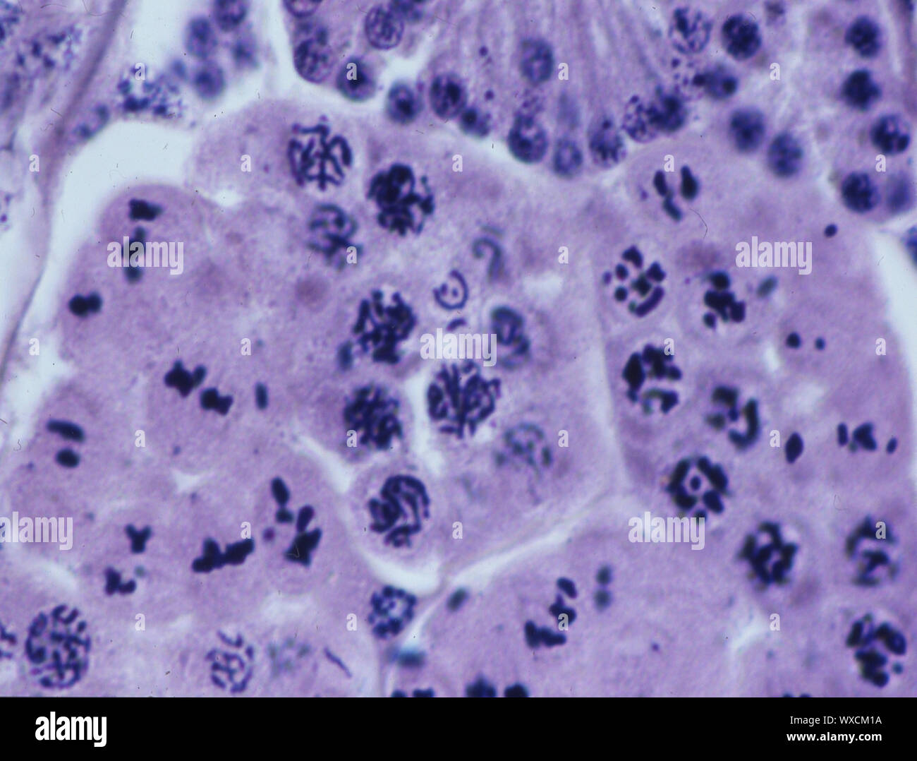 La mitose dans les cellules de l'organisme sous le microscope 100x Banque D'Images