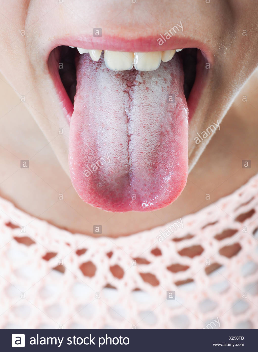 Papillae Tongue Photos & Papillae Tongue Images Alamy