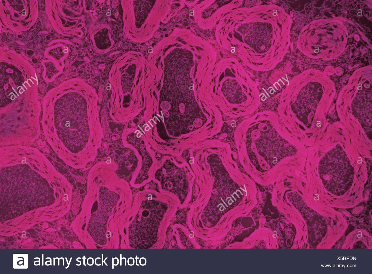 Nerf Optique Banque d'image et photos Alamy