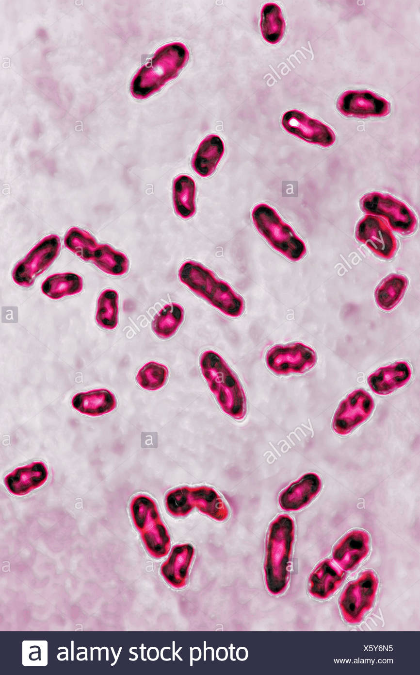 yersinia-pestis-bacteria-banque-d-image-et-photos-alamy