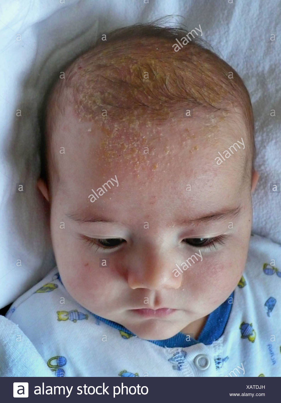 Bébé avec chapeau de berceau Photo Stock - Alamy