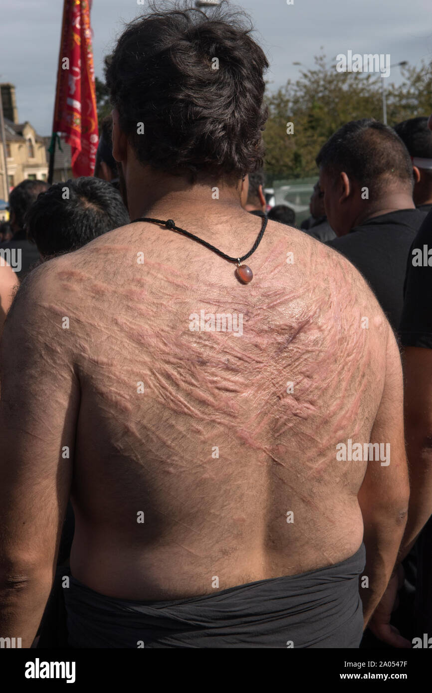 Auto flagellazione cicatrici di percosse con catene e spade, comunità musulmana Bradford 2019 2010S UK. Giorno di Ashura parade musulmani sciiti ricorda il martirio di Hussain Husayn ibn Ali. HOMER SYKES Foto Stock