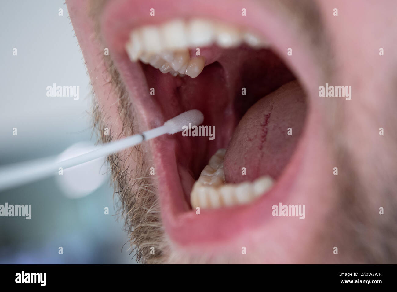 Monaco di Baviera, Germania. 26 Ago, 2019. Un uomo utilizza un tampone di cotone per prendere la mucosa orale di cellule per un campione di DNA. Credito: Sven Hoppe/dpa/Alamy Live News Foto Stock