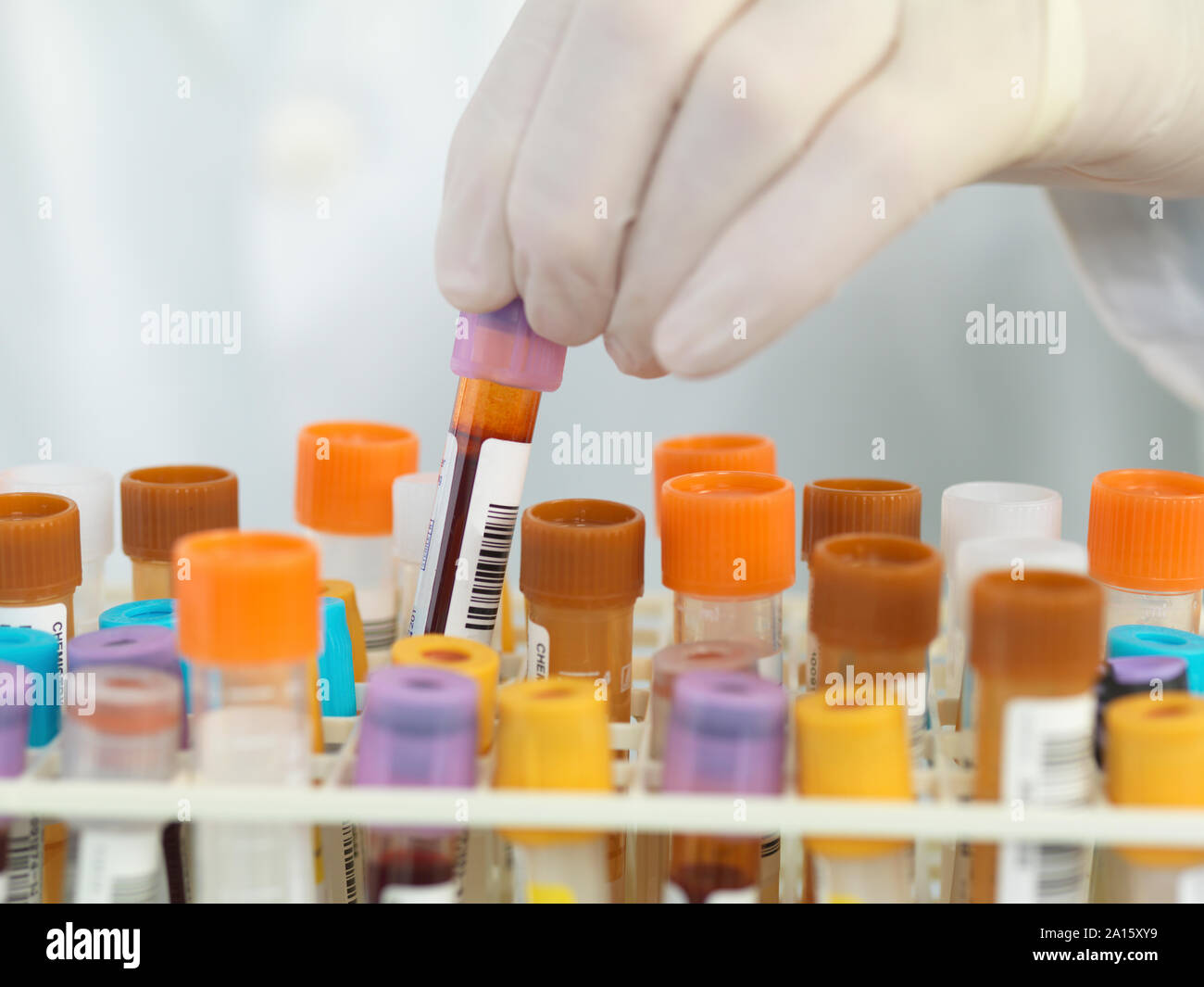 Close up medical tecnico la preparazione di campioni per analisi automatizzate in laboratorio Foto Stock