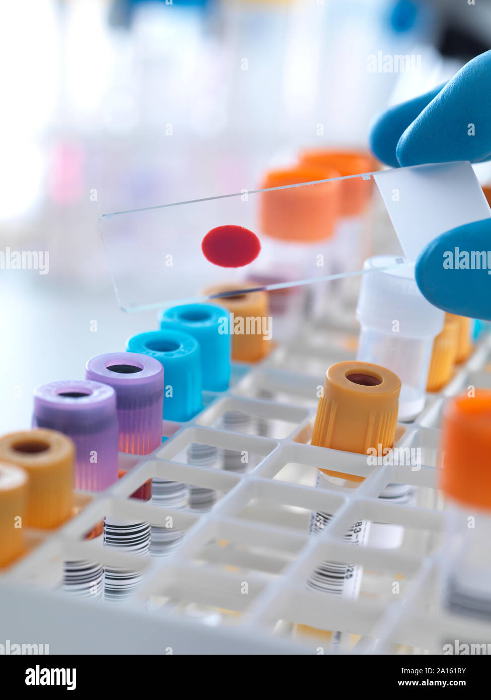 Una slitta di sangue umano essendo tenuto da un tecnico Foto Stock