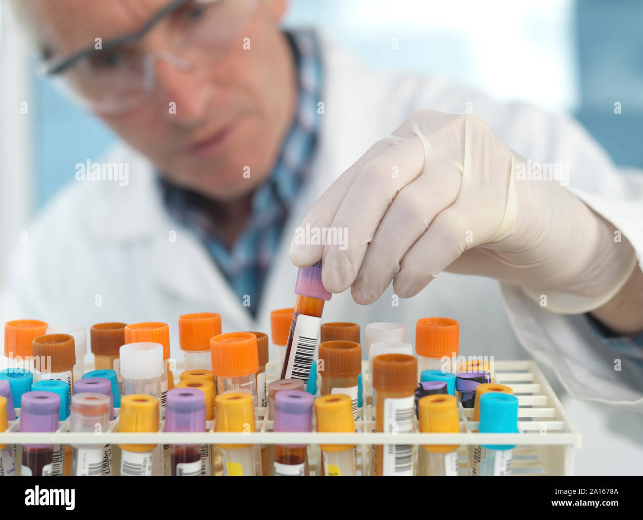 Medical tecnico verifica di campioni di sangue in laboratorio Foto Stock