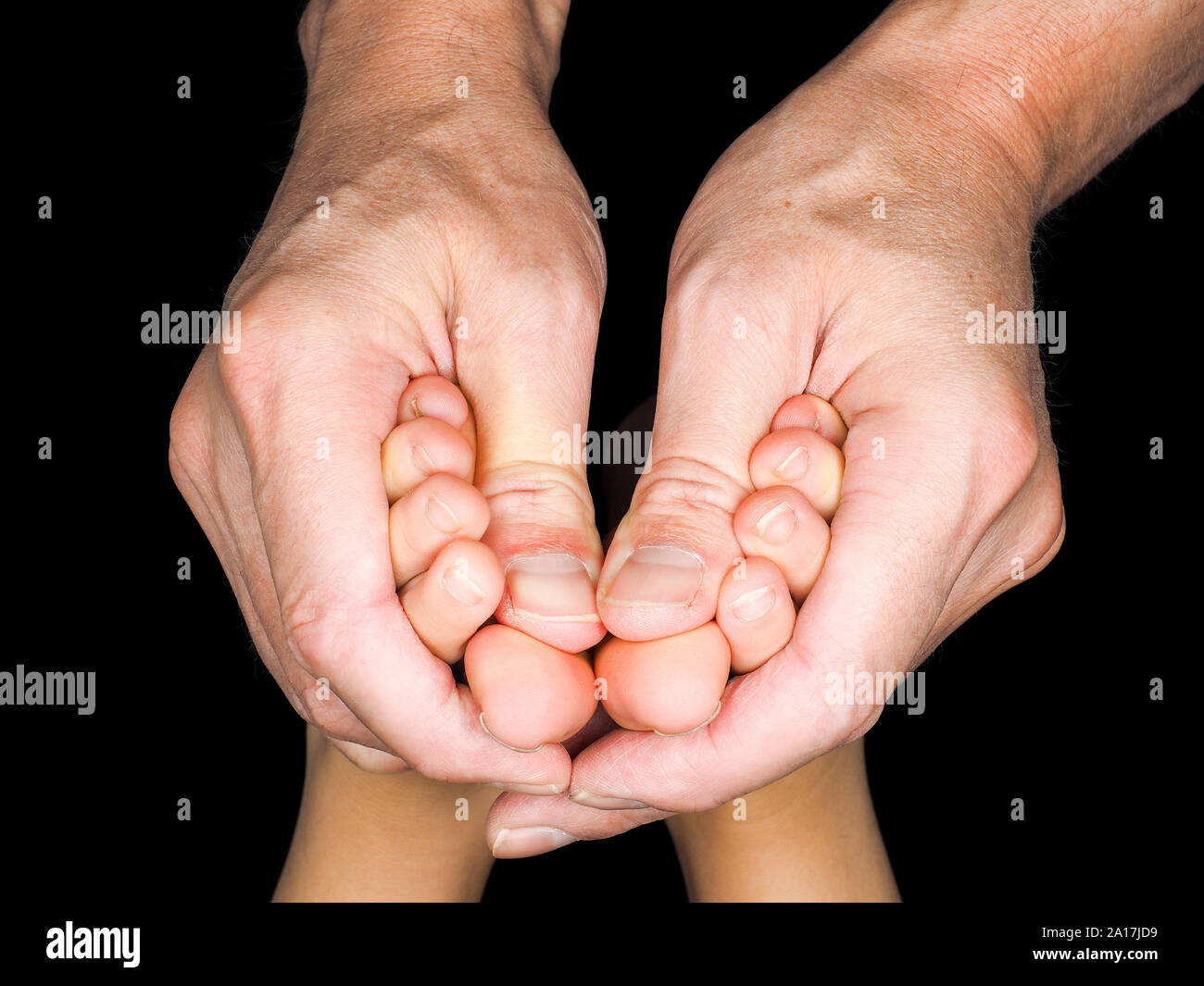 Piedi del bambino caucasico nelle mani del medico dertmatologist isolati verso il nero Foto Stock