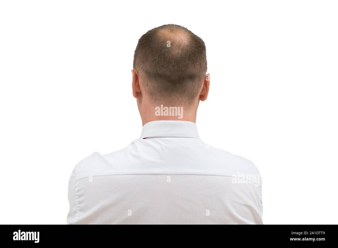 Alopecia umana o la perdita dei capelli - uomini adulti testa calva. torna di balding uomo dalle spalle isolati su sfondo bianco. Foto Stock