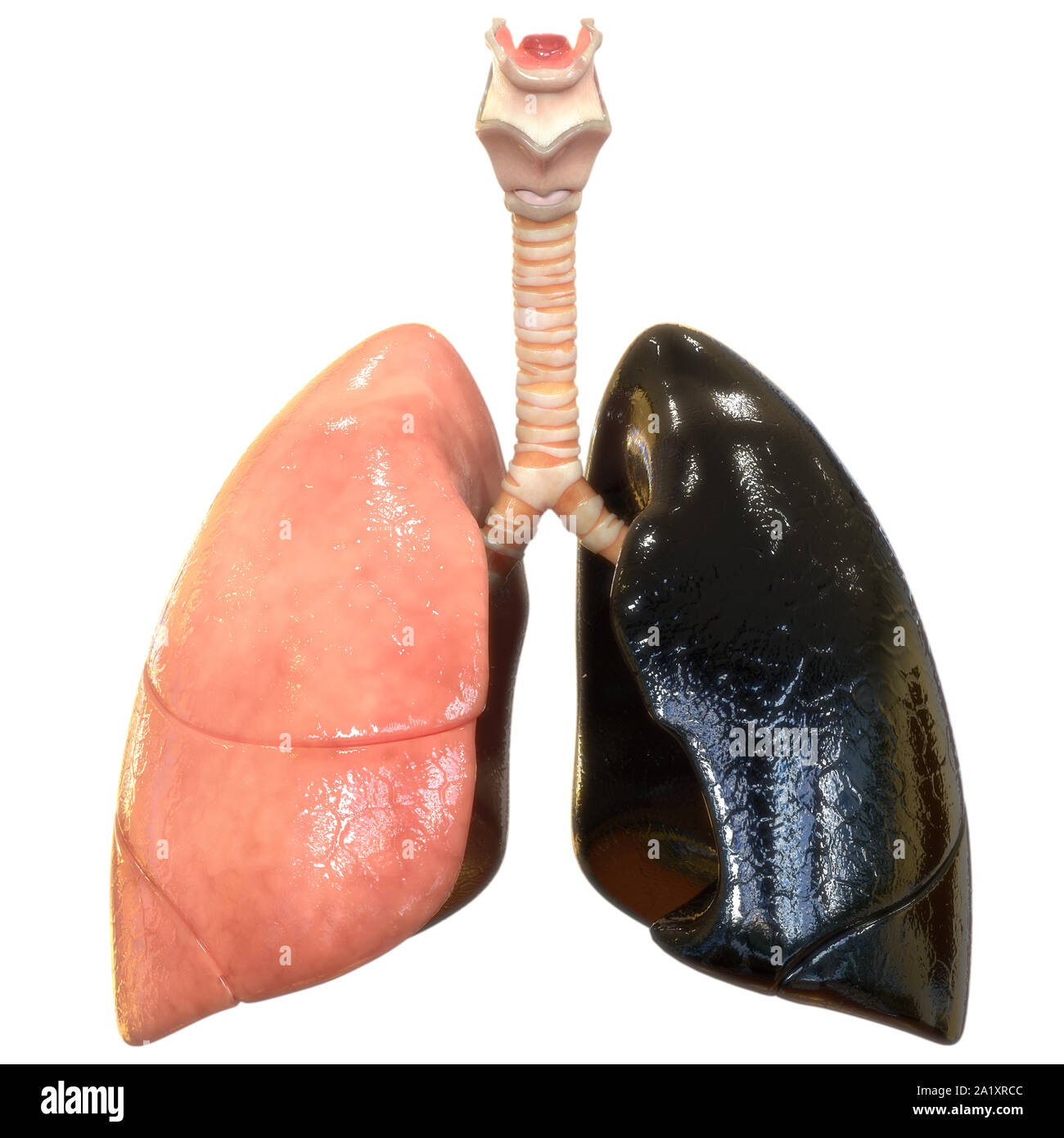 Umano Sistema respiratorio polmoni anatomia Foto Stock