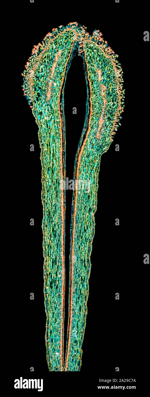 Fiore pistillo & lo stigma con il polline, campo oscuro fotomicrografia Foto Stock