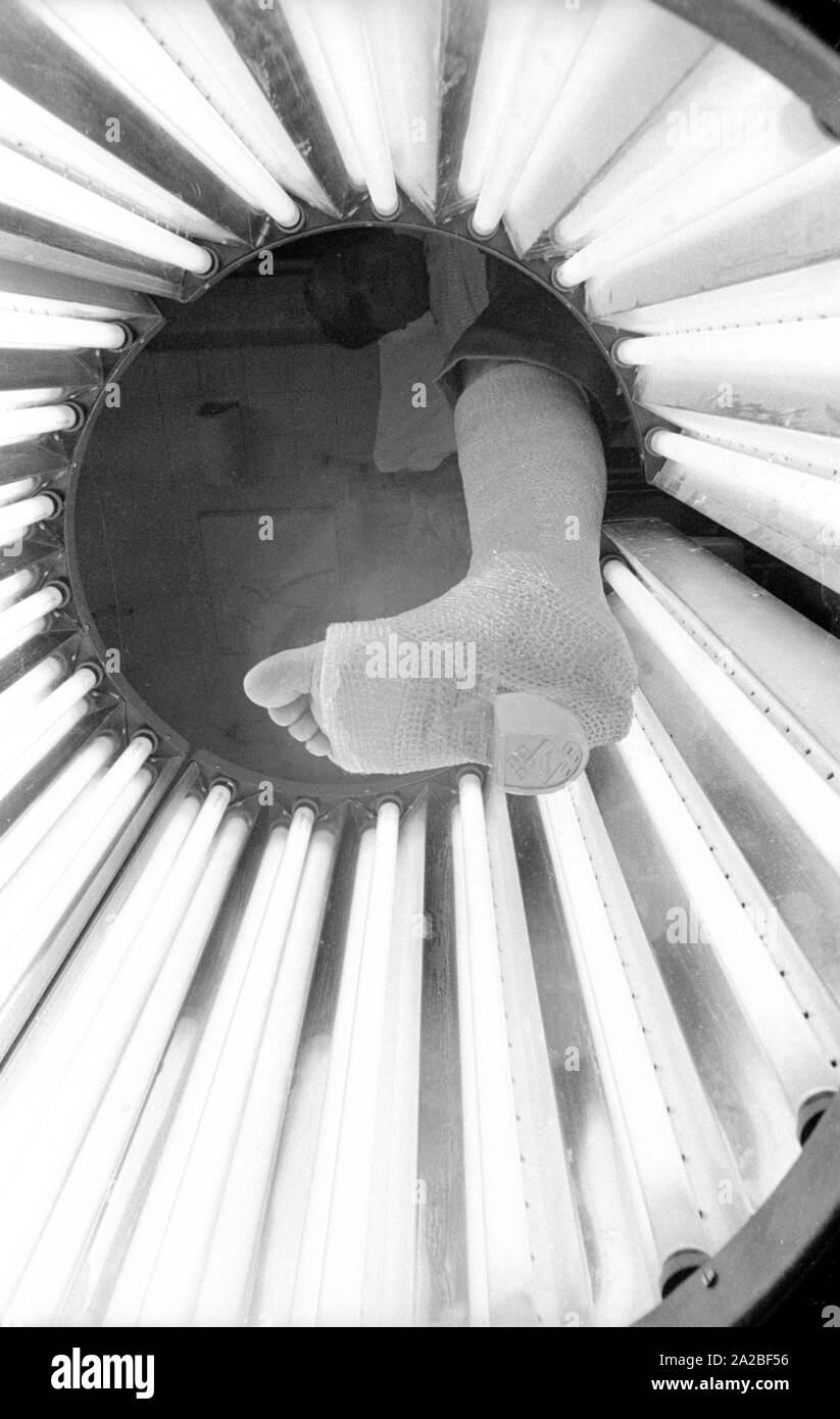 Un piede intonacata in un tubo luminoso. Presumibilmente questo è 'Lightcast 3M', un bendaggio materiale che indurisce sotto luce ultravioletta. Foto Stock