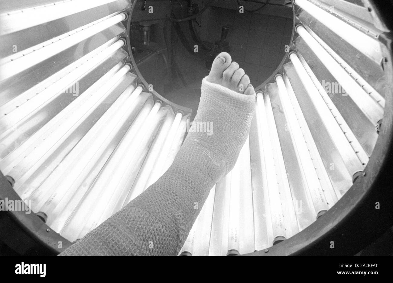 Un piede intonacata in un tubo luminoso. Presumibilmente questo è 'Lightcast 3M', un bendaggio materiale che indurisce sotto luce ultravioletta. Foto Stock