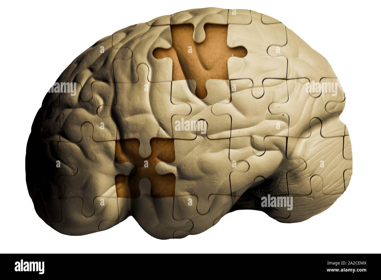 Cervello umano e puzzle con pezzi mancanti - il morbo di Alzheimer Foto Stock
