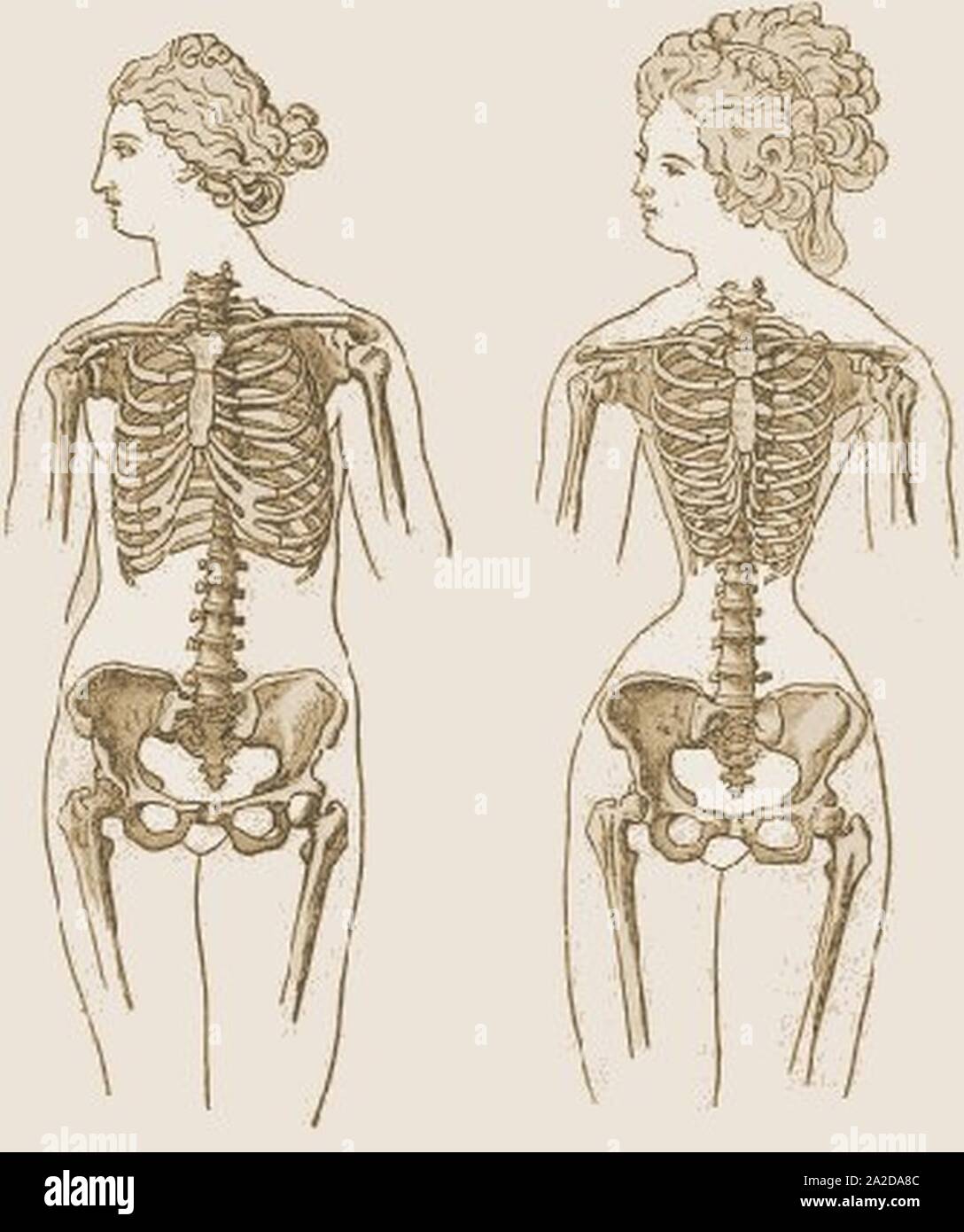 Effetto del corsetto nel corpo umano Foto stock - Alamy