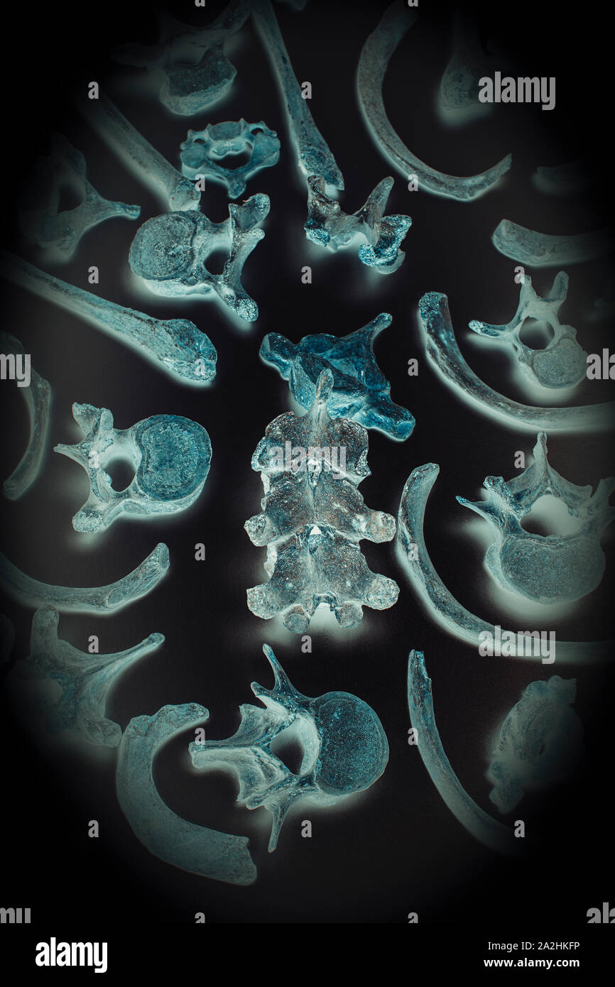 Vecchie ossa umane, costole e vertebre, immagine negativa che simula xray. concetto di medicina legale e di medicina criminale. Foto Stock