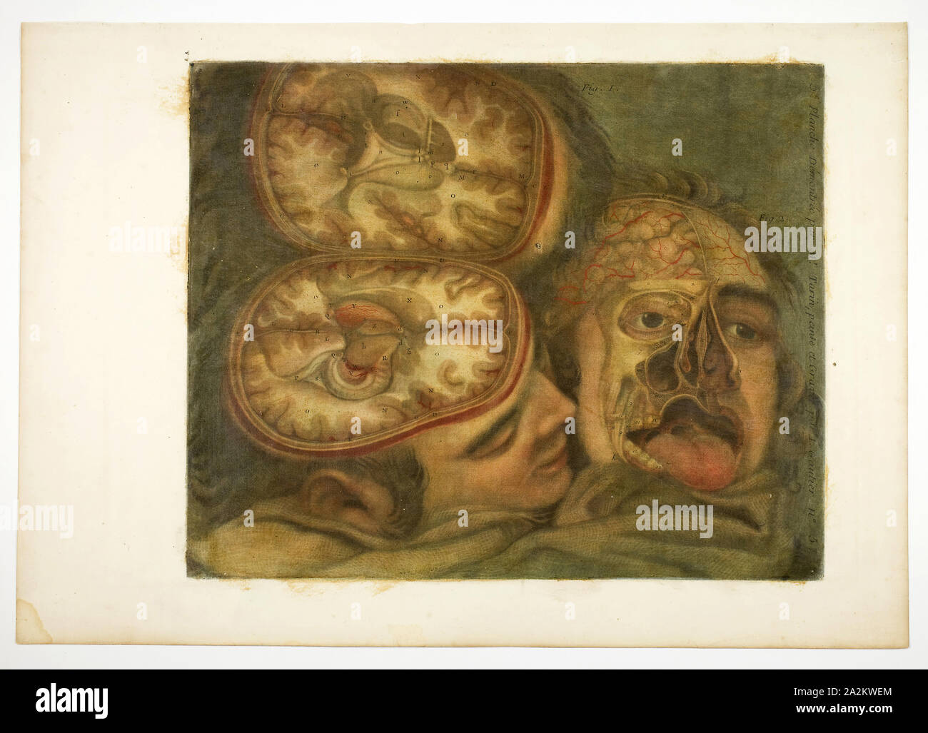 Dissezione craniale, piastra cinque dall'anatomia della testa, stampati su dipinti, 1748, Jacques Fabien Gautier D'Agoty, Francese, 1710-1781, Francia, colore mezzatinta, con tocchi di incisione sulla crema di latte di cui carta, verniciato, 320 × 400 mm (immagine/piastra), 392 × 560 mm (foglio Foto Stock
