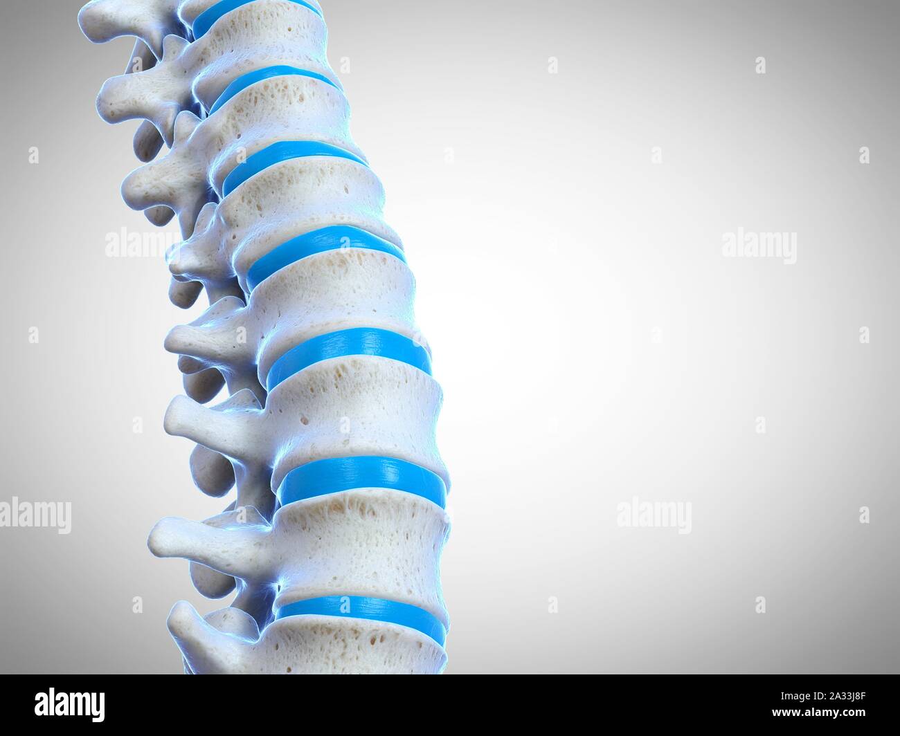 Modello Anatomico Della Colonna Vertebrale Lombare Con Ernia Del Disco – 1:1,5 Per Studio E Insegnamento