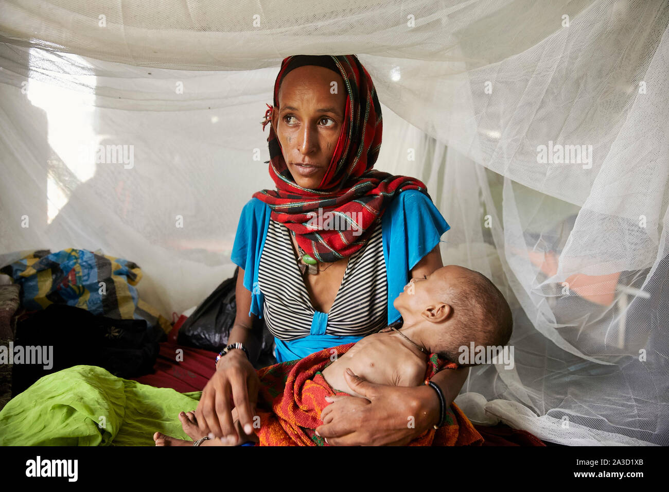 Tsjaad Ciad Mongo e Fatimi Soumaine sono il paziente in ospedale 21-6-2016 foto: Jaco Klamer Foto Stock