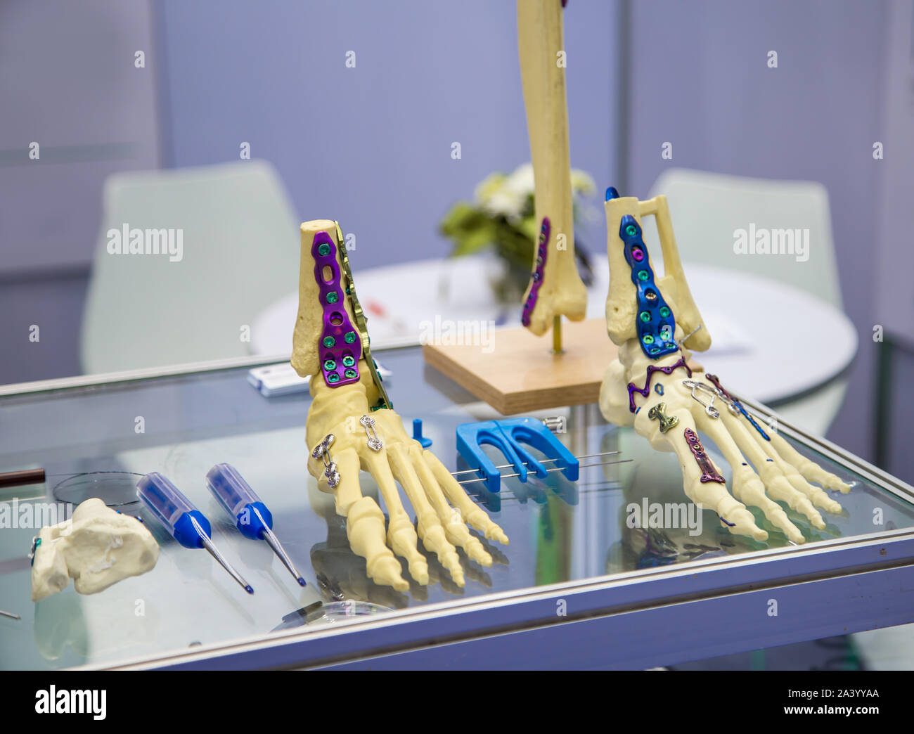 Traumatologia / osteosintesi chirurgia ossea le piastre di blocco sistema Foto Stock