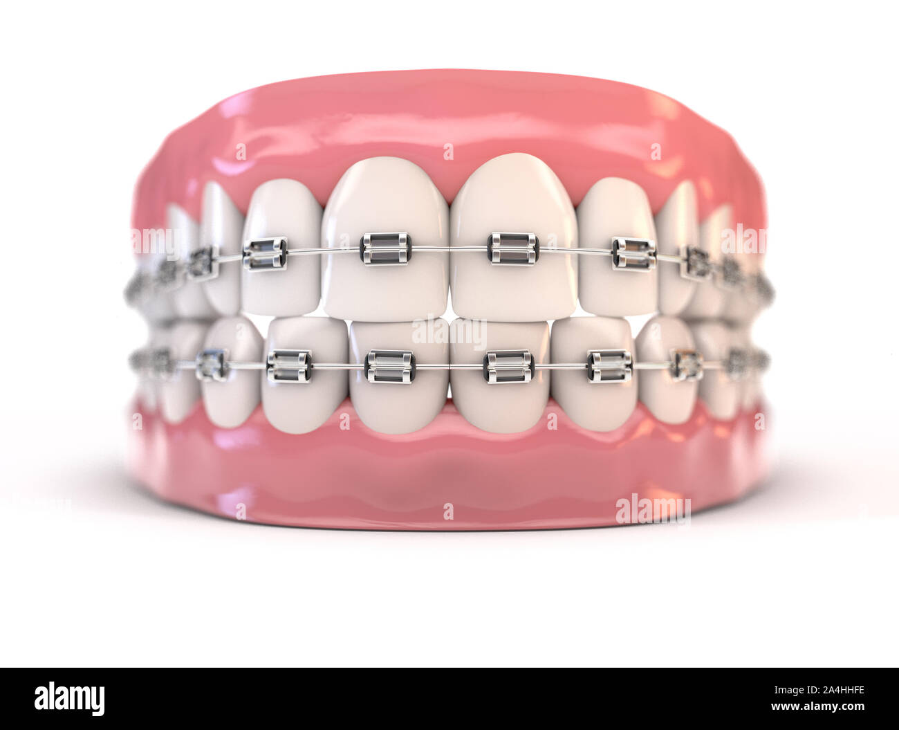 Una coppia di superiore e inferiore di insiemi di perfetta denti umani dotati di acciaio bretelle dentali isolato su un background - 3D render Foto Stock