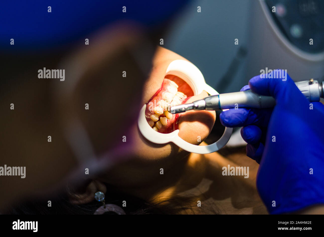 Odontologo immagini e fotografie stock ad alta risoluzione - Alamy