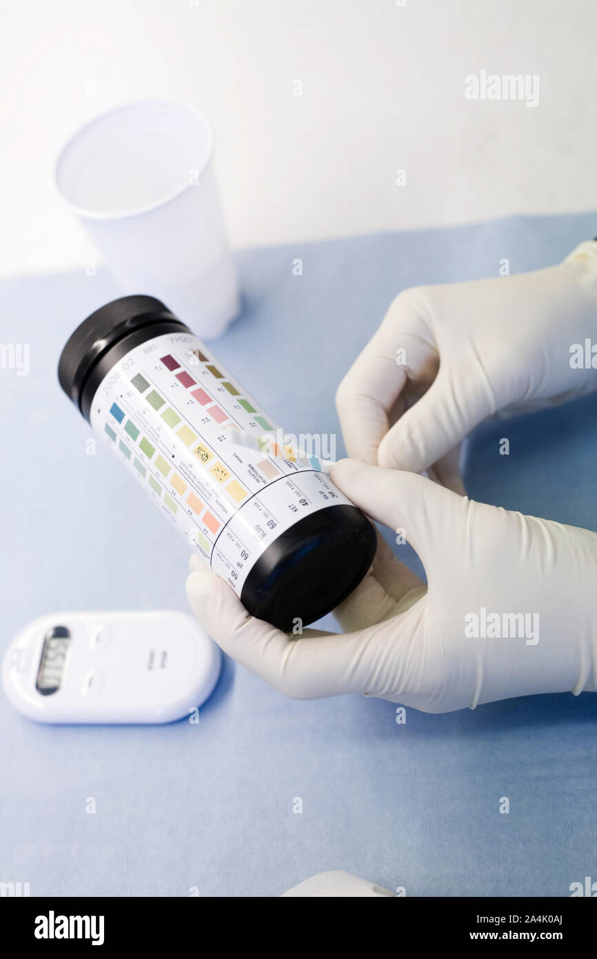 Al tornasole strisce per test di pH Foto Stock