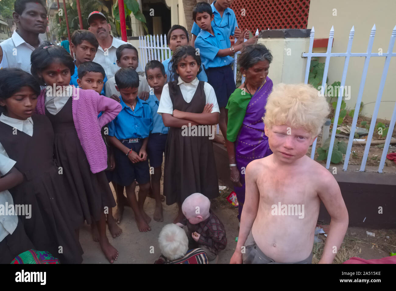 Albino boys, di membri di un indiano estesa famiglia Albini richiedono donazioni in Udipi, Karnataka, India, fissò da una folla di bambini locali Foto Stock