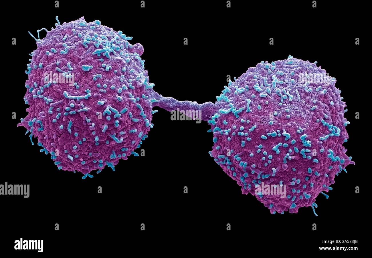 Dividendo di cellule di cancro della prostata, SEM Foto Stock