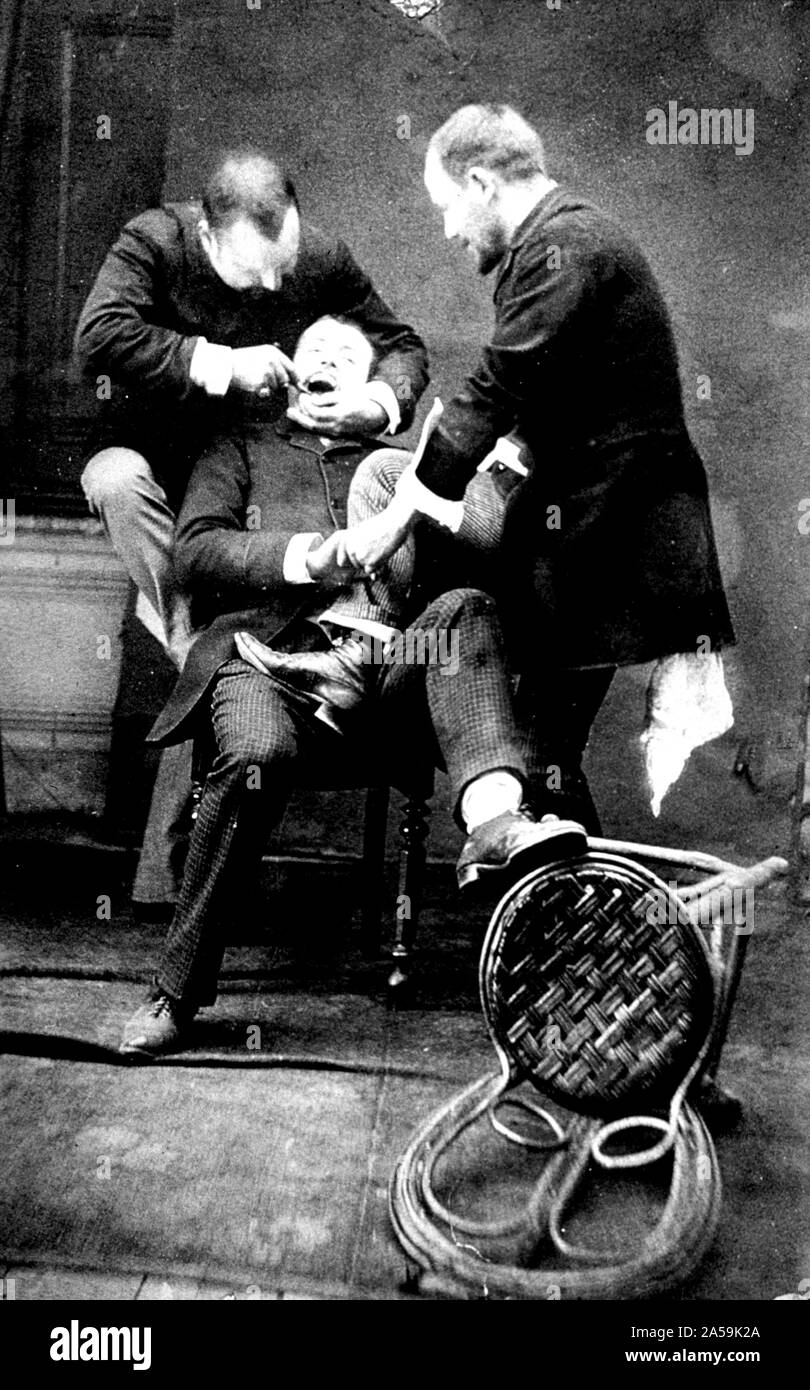 Un paziente è seduto in una sedia; un assistente dentale ha il suo piede sul paziente; giro dietro di loro il dentista ha il suo braccio intorno alla testa del paziente e il lavoro è uno strumento odontoiatrico nella bocca del paziente Foto Stock