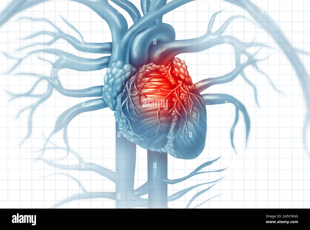 Le malattie cardiovascolari di cuore umano dolore di attacco come una anatomia medica nozione di malattia con una persona che soffre di una malattia cardiaca come un doloroso. Foto Stock