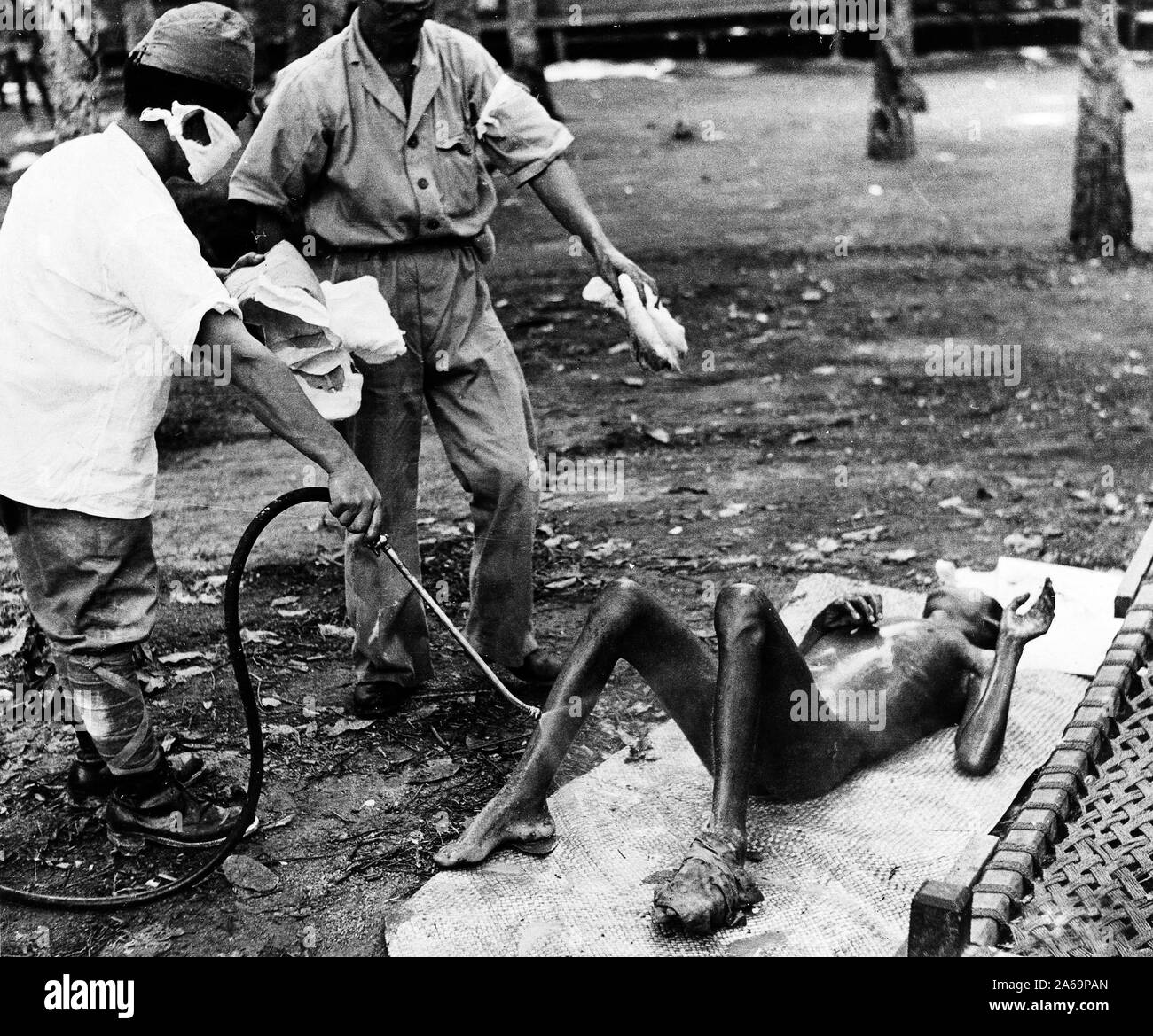 Giapponese medical orderlies spray disinfettanti su un coolie soffre di beri-beri a un giapponese lavoro forzato camp a Seletah, nella parte settentrionale dell'isola di Singapore. Quando la British trovato accidentalmente il camp è stato compiuto uno sforzo per ripulire il computer e scaricare i malati che soffrono di fame e di sporco sulle condizioni di vita. Foto Stock