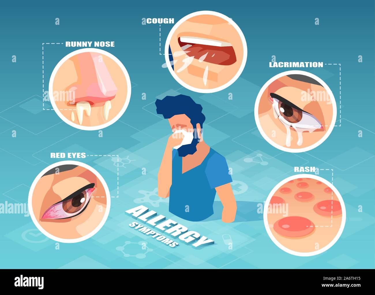 I sintomi delle allergie concetto. Vettore di un malato starnuti man aventi tosse, rash cutaneo, naso che cola, Occhi dolenti Illustrazione Vettoriale