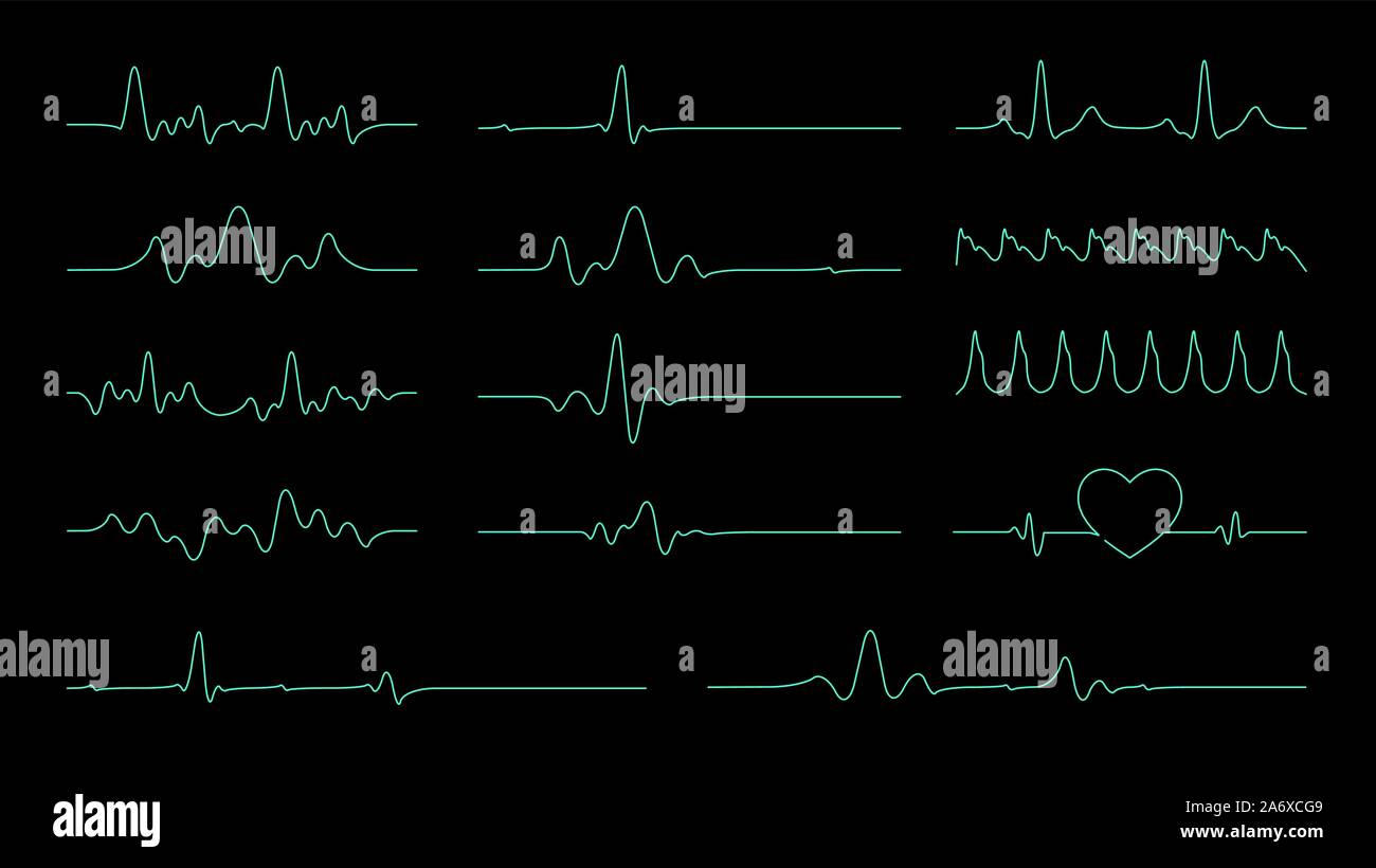 La linea di impulsi vettore collezione per l'elemento sulla frequenza cardiaca e Cardiogram monitor. Illustrazione Vettoriale