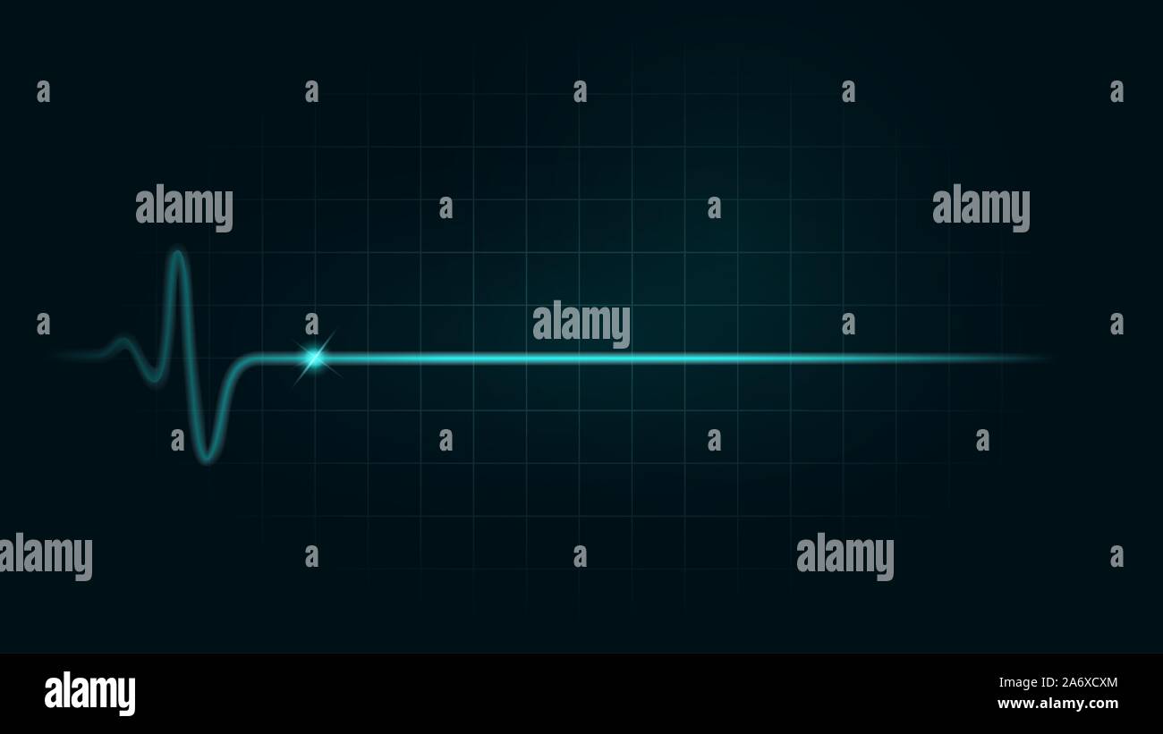 La frequenza del polso linea mentre morti sul verde sfondo grafico del monitor. Illustrazione circa l'insufficienza cardiaca. Illustrazione Vettoriale