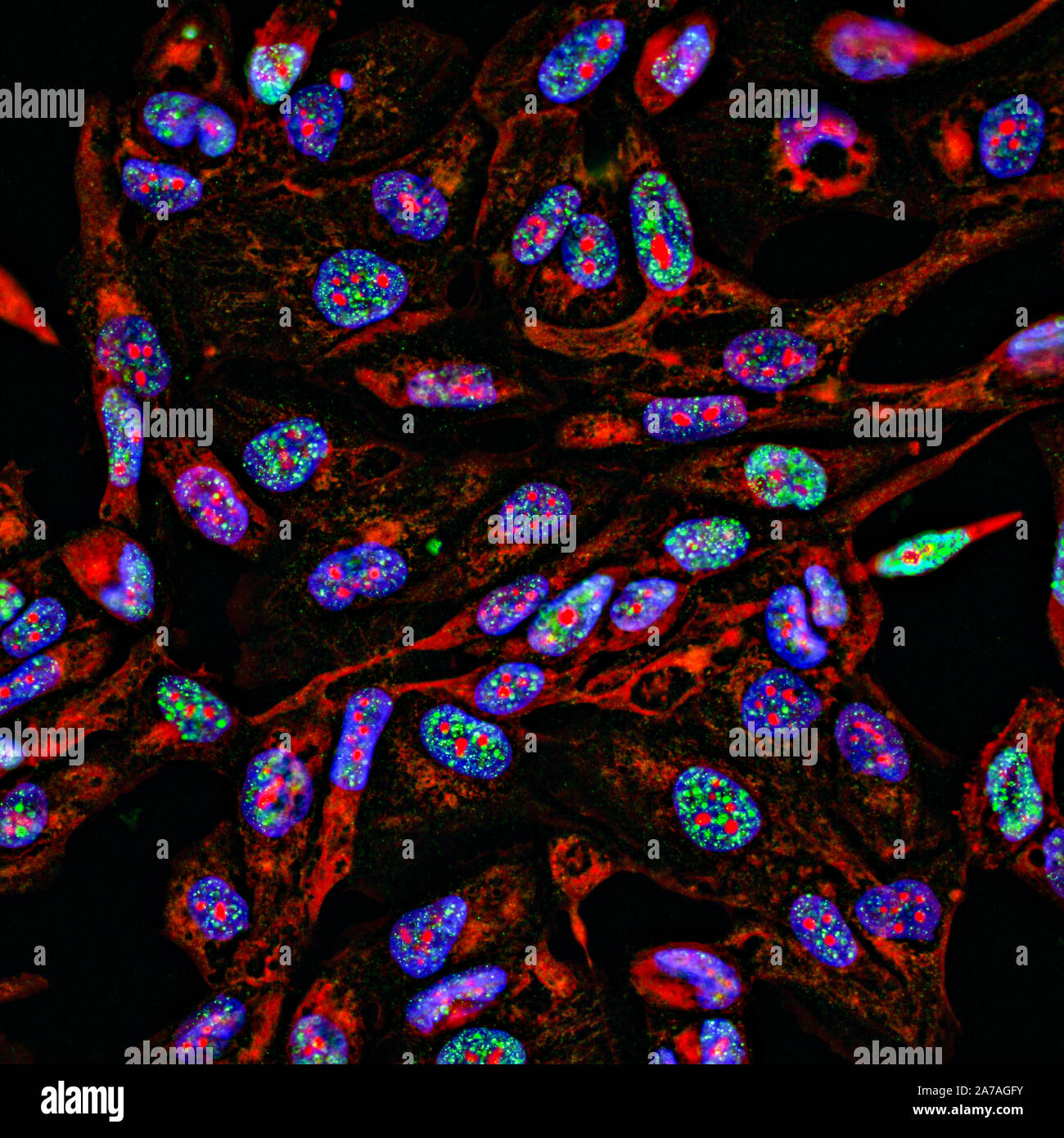 Imaging fluorescenti di immunofluorescenza le cellule del cancro in crescita in 2D con nuclei in blu, citoplasma in rosso e danno del DNA fuochi in verde Foto Stock