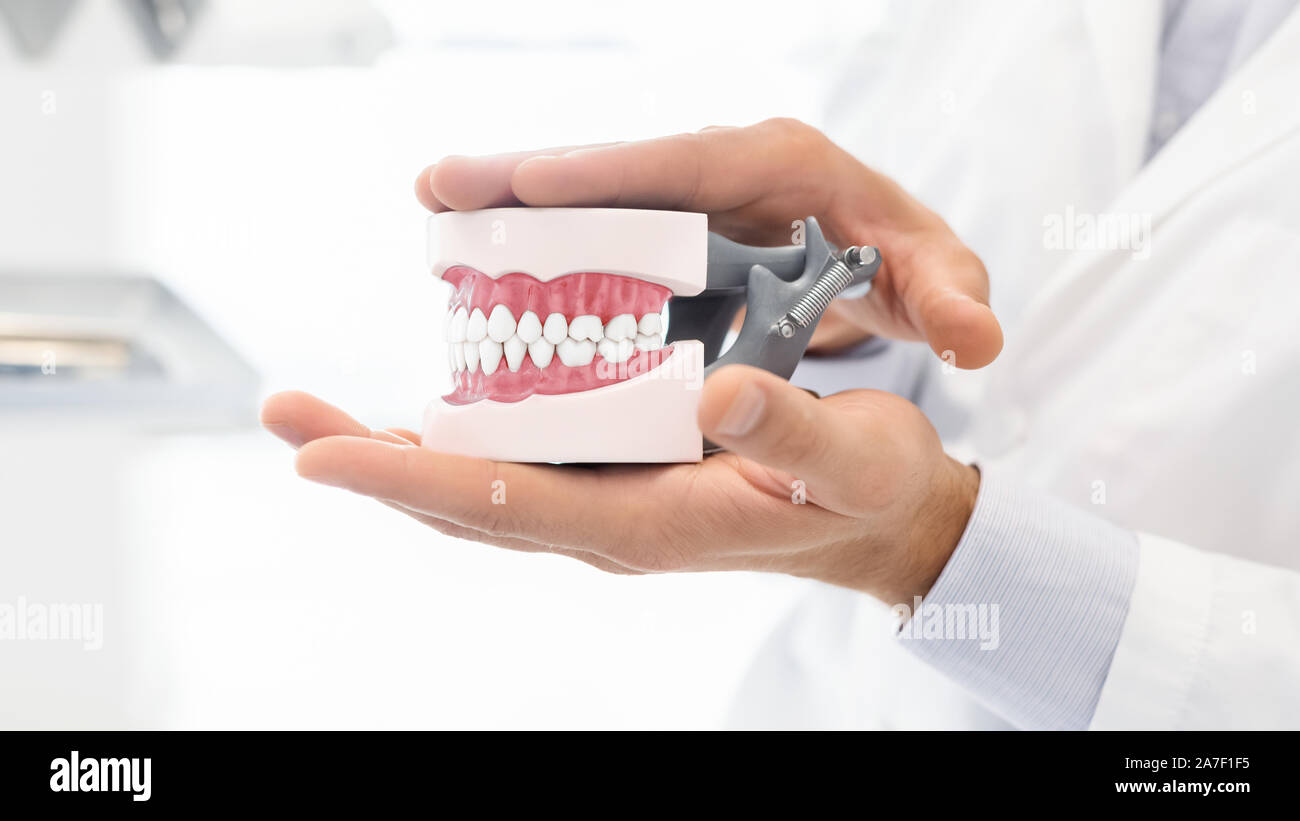 Le mani del dentista tenendo in plastica modello di ganascia Foto Stock