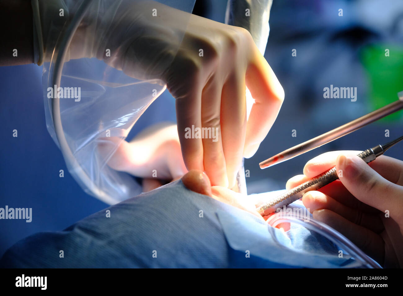 Le mani del dentista e dell'assistente in guanti di protezione con lo strumento nel trattamento del paziente Foto Stock Le mani del dentista e dell'assistente in guanti di protezione con lo strumento nel trattamento del paziente Foto Stock