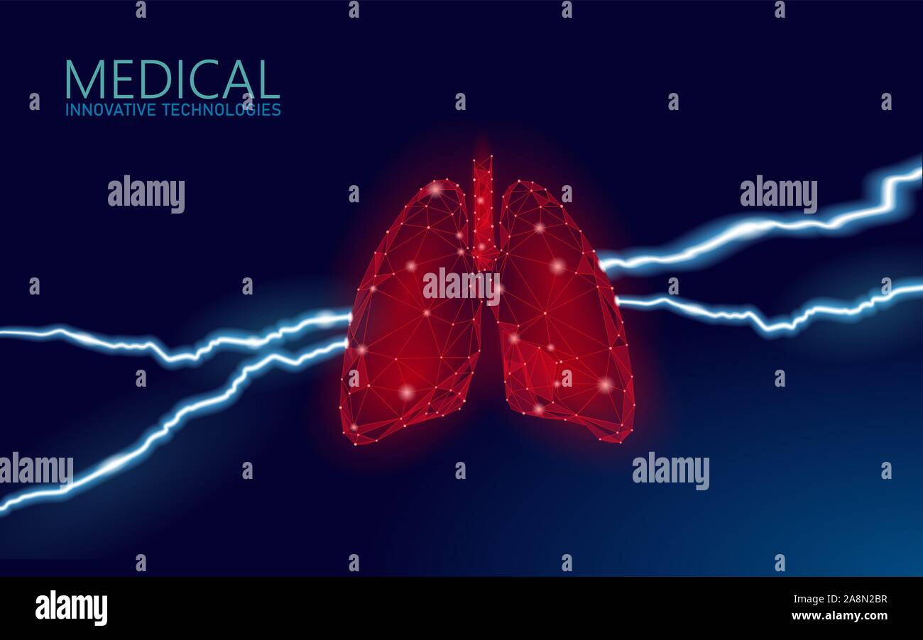 Concetto di medicina di prevenzione delle malattie dei polmoni umani 3D. Infezione da virus respiratorio pericolo di cancellazione. Doloroso malato terapia medica ospedale tubercolosi Illustrazione Vettoriale Concetto di medicina di prevenzione delle malattie dei polmoni umani 3D. Infezione da virus respiratorio pericolo di cancellazione. Doloroso malato terapia medica ospedale tubercolosi Illustrazione Vettoriale
