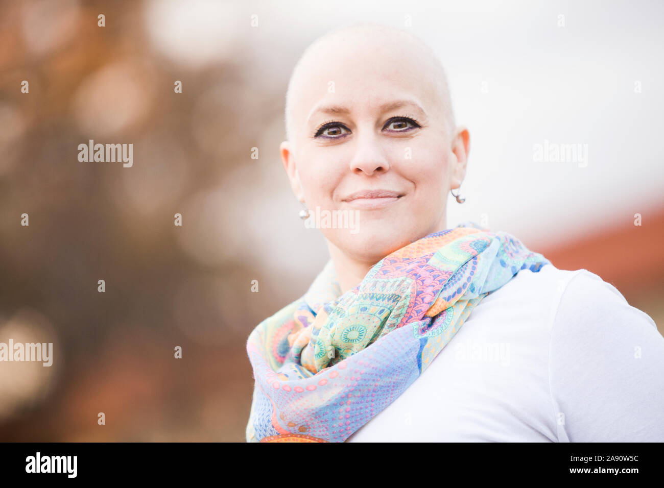 Ritratto di una bella donna in grassetto durante il trattamento del cancro della chemioterapia. Foto Stock