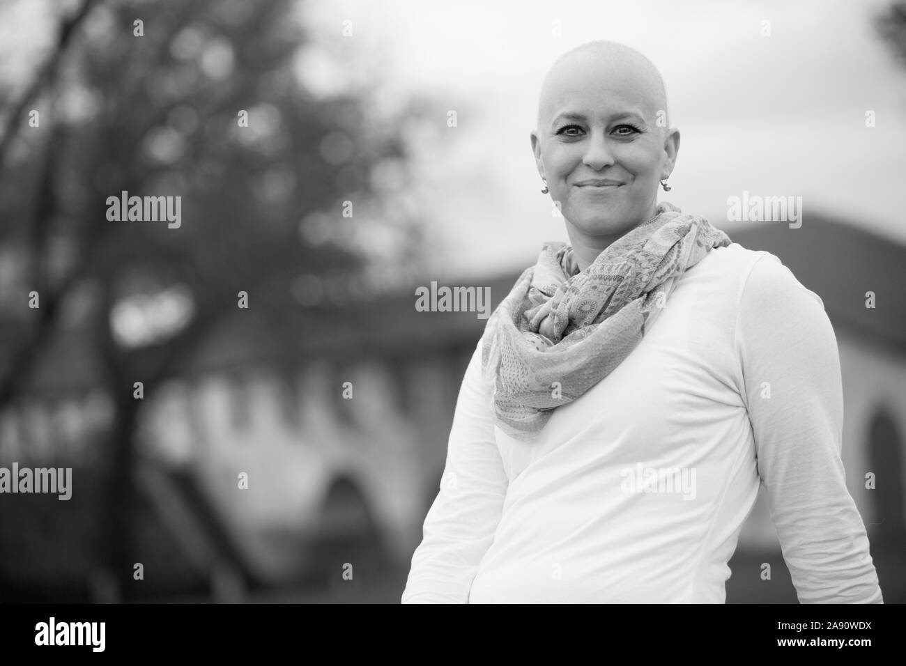 Ritratto di una bella donna in grassetto durante il trattamento del cancro della chemioterapia. Foto Stock