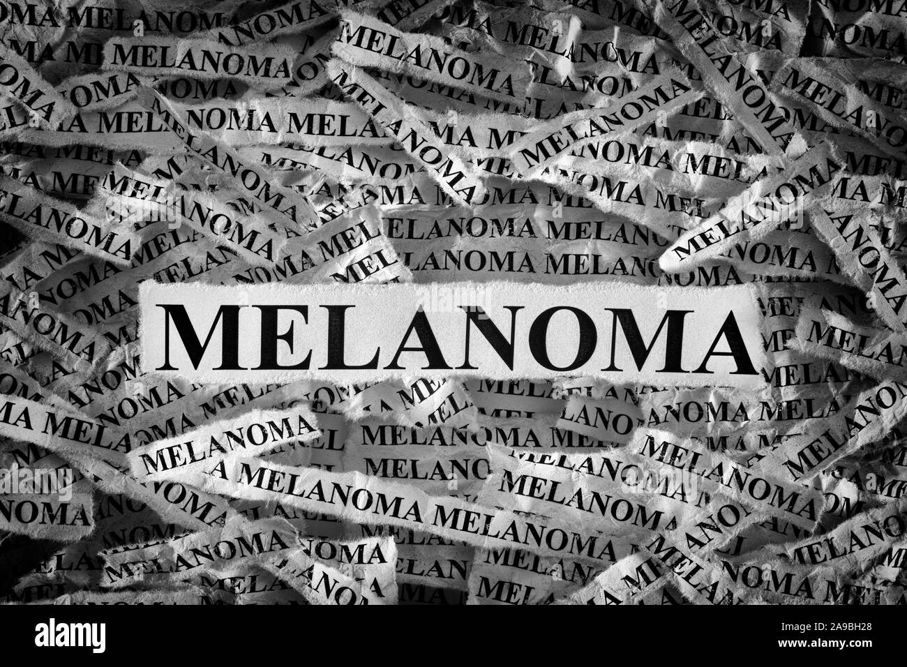 Il melanoma. Pezzi di carta strappati con le parole il melanoma. In bianco e nero. Close up. Foto Stock