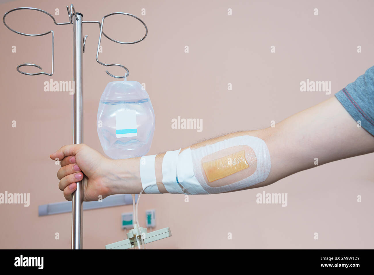 A buon mercato medico sistema di infusione con cancro braccio del paziente in ospedale poveri Foto Stock